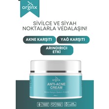 Sivilce Önleyici Ve Sivilce Karşıtı Anti - Akne Siyah Nokta Önleyici Krem 50 ml