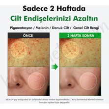 Dr. Althea %20 Gentle Vitamin C Serum - 30ml