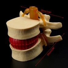 Hongliang Shop C  Anatomik Bel Omur Disk Herniasyon Anatomi Eğitim Aracı (Yurt Dışından)