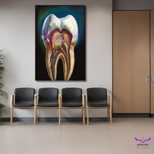 Abart Art Tekli Dikey Kanvas Diş Poliklinik Tablosu Kanal Tedavili Diş Tasarımı