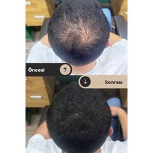 Hairboost Erkek Saç Kapatıcı Dolgunlaştırıcı Krem 50 ml 3 Adet (1 Adet Tarak Hediyeli)
