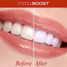 Ultradent Opalescence Boost PF Tekli