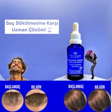 NİCE TOUCH KOZMETİK1 Adet Saç Serum , Saç Vitamini+ 1 Adet Dermaroller