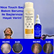 NİCE TOUCH KOZMETİK1 Adet Saç Serum , Saç Vitamini+ 1 Adet Dermarroler+1 Adet Şampuan
