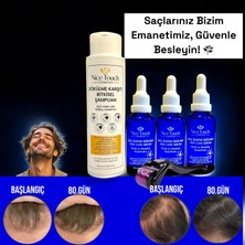 NİCE TOUCH KOZMETİK 3 Adet Saç Serum , Saç Vitamini+ 1 Adet Dermarroler+ 1 Adet Şampuan