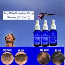 NİCE TOUCH KOZMETİK3 Adet Saç Serum , Saç Vitamini+ 1 Adet Dermarroler