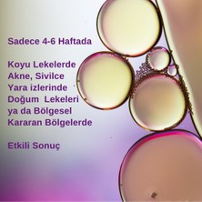 ikaglaie Leke Serumu Güneş,Doğum,Yaşlanma Lekeleri ve Kararan Bölgelerde Etkili (Saf C Vitamini,Alpha-Arbutin,Niacinamide ile)