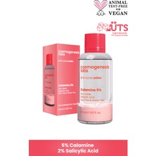 Akne Karşıtı Losyon 30ml – Akne Yatıştırıcı, Siyah Nokta Azaltıcı Vegan (%5 Calamine – Yeşil Çay)