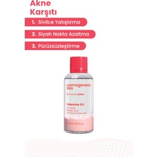 Akne Karşıtı Losyon 30ml – Akne Yatıştırıcı, Siyah Nokta Azaltıcı Vegan (%5 Calamine – Yeşil Çay)
