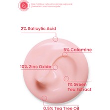 Akne Karşıtı Losyon 30ml – Akne Yatıştırıcı, Siyah Nokta Azaltıcı Vegan (%5 Calamine – Yeşil Çay)