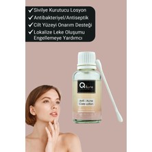 Q LUNE Sıvilce ( Akne ) Kurutucu Losyon / Gözenekleri Sıkılaştıran Losyon 30 Ml(ANTİ ACNE CARE LOSİON)