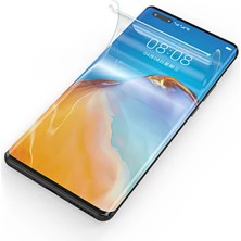 Redmi Note 13 Hydrogel Parlak Ekran Koruyucu