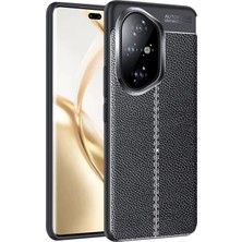 Microcase Honor 300 ile Uyumlu Leather Serisi Deri Efekt Silikon Kılıf - Siyah AL3337