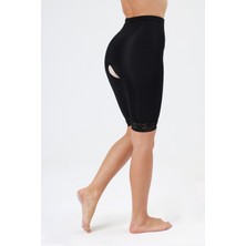 Lipoteks Belden Dizüstü Liposuction Korse