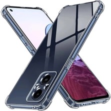 Caseworld Oneplus Nord N20 5g Kapak Kamera Korumalı Airbag Antishock Köşe Korumalı Şeffaf Silikon Kılıf