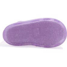 Igor S10265 Star Glitter Lila Ortopedik Günlük Kız Çocuk Sandalet
