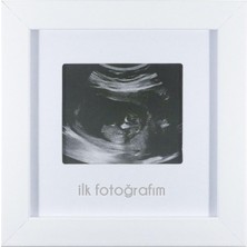 Store Ilk Fotoğrafım Bebek Ultrason Çerçevesi - Bebek Odası Resim Anı Çerçevesi