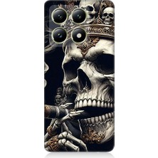 Teknomeg Xiaomi 14T Uyumlu Taçlı Kafatası  Desenli Silikon Kılıf