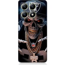 Teknomeg Xiaomi 14T Pro Uyumlu Karanlık Korsan  Desenli Silikon Kılıf