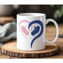 BB Design BB Desing Kız Erkek Bebek Tasarımlı Beyaz Seramik Baskılı Kupa Bardak 330 ml