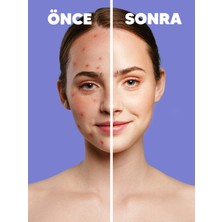 Zederma Bakım Seti, Tonik Serum 80 Li Pamuk