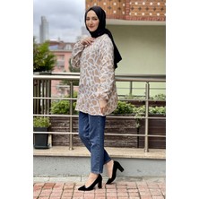 Kent Moda Desenli Tunik