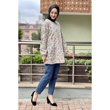 Kent Moda Desenli Tunik