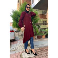 Kent Moda Desenli Tunik