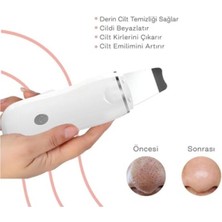 Hediye Rüzgarı Elektrikli Ultrasonik Cilt Scrubber Titreşim Yüz Spatula Soyma Siyah Nokta Yüz Kaldırma Temizleme Ultrasonik Cilt Bakımı
