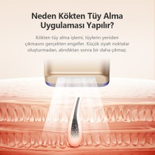 Mlay Lazer Epilasyon Cihazı LED Ekran 500000 Flaş Ipl Fotoepilatör Epilasyon