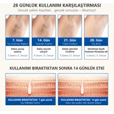 Mlay Lazer Epilasyon Cihazı LED Ekran 500000 Flaş Ipl Fotoepilatör Epilasyon