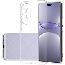 Teleplus Huawei Nova 13 Pro Kılıf Kamera Korumalı Tpu Silikon