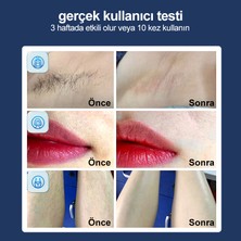 Lazer Epilasyon Cihazı 500.000 Flaş 3 Başlık Vücut Yüz Özel Bölge Bay Bayan Epilasyon Ultra Seri Atım