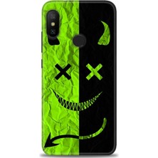 Xiaomi Mi A2 Lite Kılıf Hd Baskılı Kılıf + Seramik Tam Kaplayan Ekran Koruyucu 360