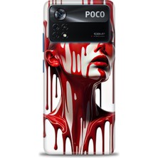 Kılıf Evreni Xiaomi Poco X4 Pro 5g Uyumlu A+ Plus Kılıf + SERAMİK KIRILMAZ EKRAN KORUYUCU 150