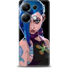 Kılıf Evreni Xiaomi Redmi Note 13 Pro 4g Uyumlu A+ Plus Kılıf + SERAMİK KIRILMAZ EKRAN KORUYUCU 271