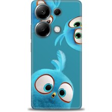 Kılıf Evreni Xiaomi Redmi Note 13 Pro 4g Uyumlu A+ Plus Kılıf + SERAMİK KIRILMAZ EKRAN KORUYUCU 364