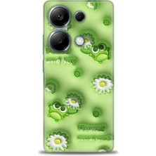 Xiaomi Redmi Note 13 Pro 4g Hd Baskılı Kılıf + Seramik Tam Kaplayan Ekran Koruyucu 116