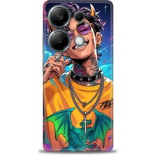 Xiaomi Redmi Note 13 Pro 4g Hd Baskılı Kılıf + Seramik Tam Kaplayan Ekran Koruyucu 259