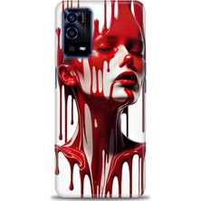 Kılıf Evreni Oppo A55 4g Uyumlu A+ Plus Kılıf + SERAMİK KIRILMAZ EKRAN KORUYUCU 150