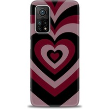 Kılıf Evreni Xiaomi Mi 10T Kılıf Hd Baskılı Kılıf + Seramik Tam Kaplayan Ekran Koruyucu 191