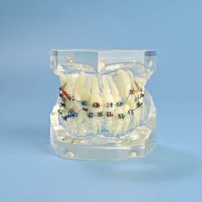 Dental Çıkarılabilir Şeffaf Birincil Modeli Çalışması Dökme Ortodonti Şeffaf Metal Braket Ligatür Bağı Diş Modeli