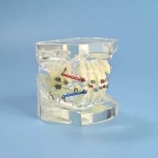 Dental Çıkarılabilir Şeffaf Birincil Modeli Çalışması Dökme Ortodonti Şeffaf Metal Braket Ligatür Bağı Diş Modeli