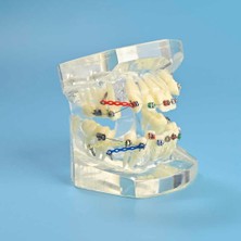 Dental Çıkarılabilir Şeffaf Birincil Modeli Çalışması Dökme Ortodonti Şeffaf Metal Braket Ligatür Bağı Diş Modeli