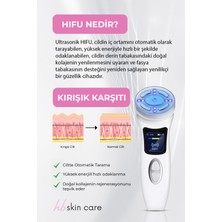 Hifu4 Cihazı