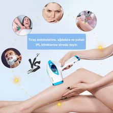 Ipl Lazer Epilasyon Tüy Alma Cihazı Yüz+Vücut+Hassas Bölge Kullanımı, Değiştirilebilir Lamba Başlığı Ipl Cihazları