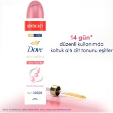 Dove Kadın Sprey Deodorant Eventone Kalendula Özü Büyük Boy 200 ml x1 Adet
