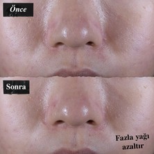 Kiehl's Ultra Facial Oil-Free Yağlı Ciltler Için 24 Saat Nemlendiren Gözenek Karşıtı Jel Krem 150 ml