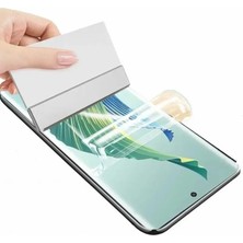 Youpick Honor 100 Pro Ekran Koruyucu Hidrojel Nano Esnek Şeffaf
