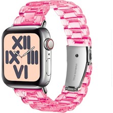 Nettech Apple Watch Series 41 mm Uyumlu Kasa Korumalı Kordon